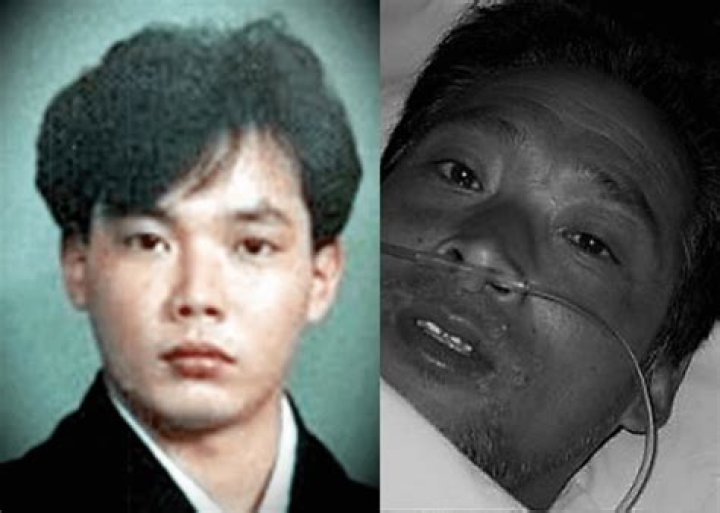 Hisashi Ouchi, The Radioactive Man Kept Alive For 83 Days